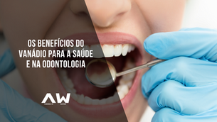 Os Benefícios do Vanádio para a saúde e na Odontologia