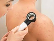 ACİLDE EN SIK GÖRÜLEN 10 DERMATOLOJİK RAHATSIZLIK