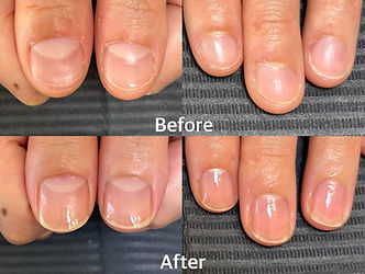 一宮市自爪育成ネイルサロンビフォーアフター