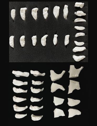 pubic bones, age determination, sex determination, identification, reference materials.