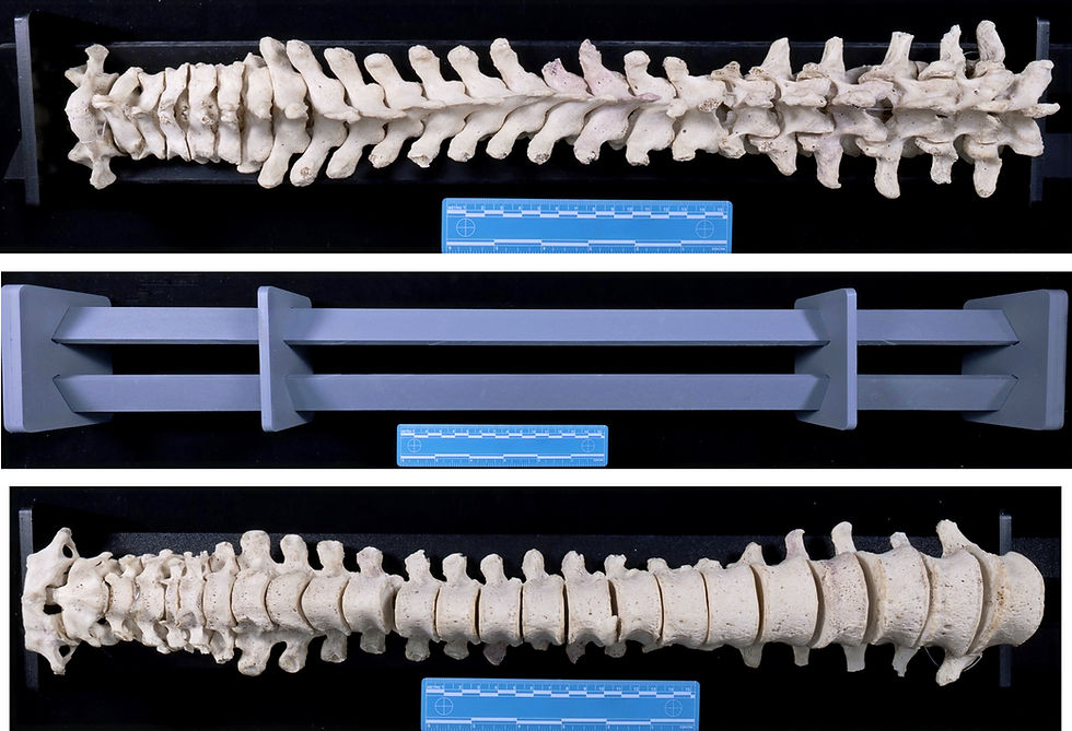 Vertebral Column Display Board