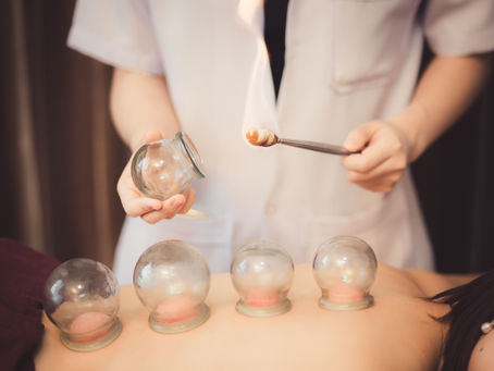 Exploring the Healing Power of Cupping Therapy