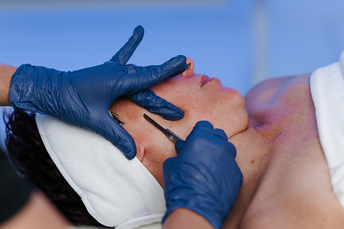 Dermaplaning.png