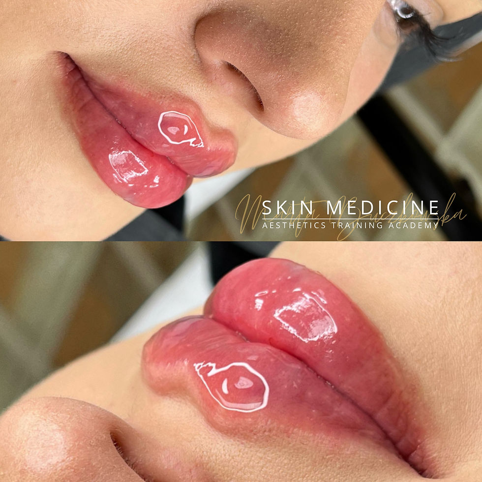 Miniatura: Harmony Lips 3D + Russian & Natural Lips