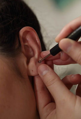 Photo Auriculothérapie Audrey Godeux