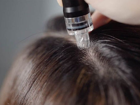 Perte de densité et chute de cheveux après l'été : que faire ?