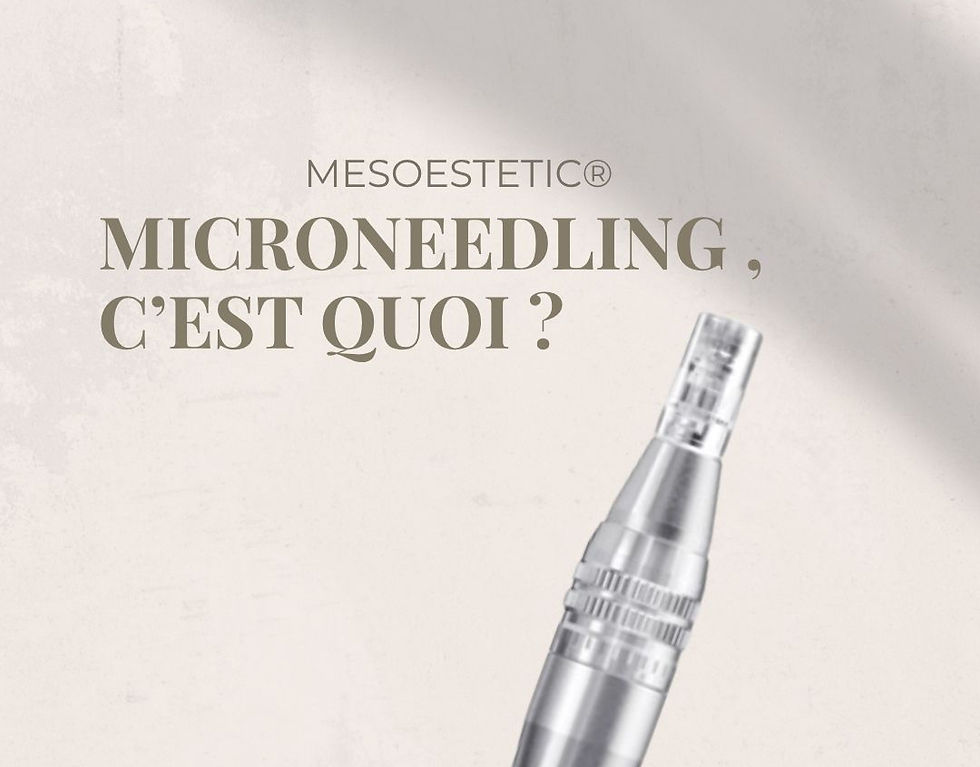 Micro-stimulation (microneedling) : une technique avancée intégrée à nos soins visage à Lyon ✨