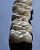 dental crown and bridge