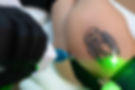 Tattoo Removal.jpg