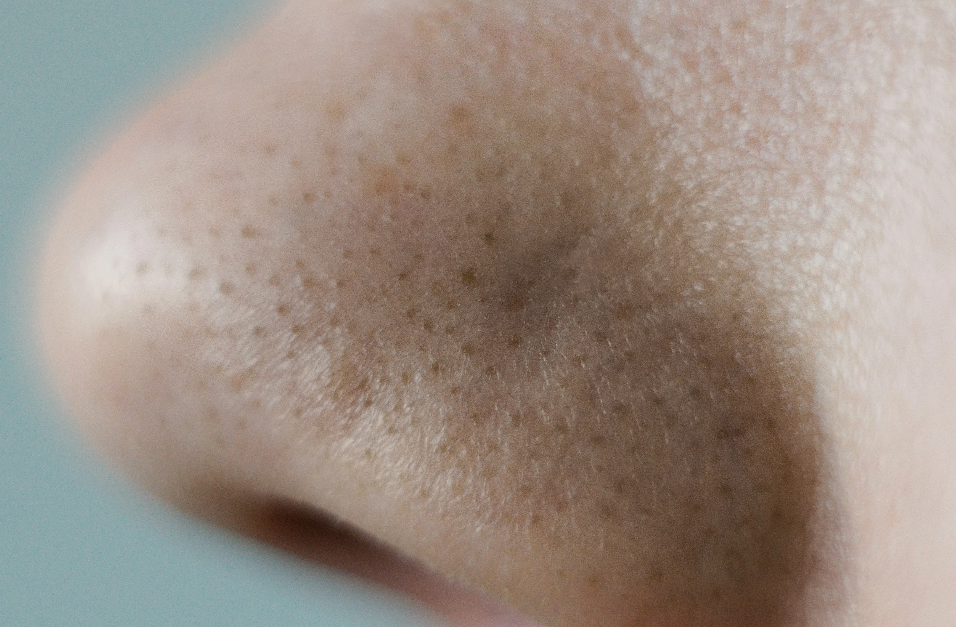 Clogged_pores.webp