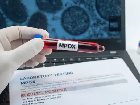 Brasil já registra 140 casos de Mpox em 2026