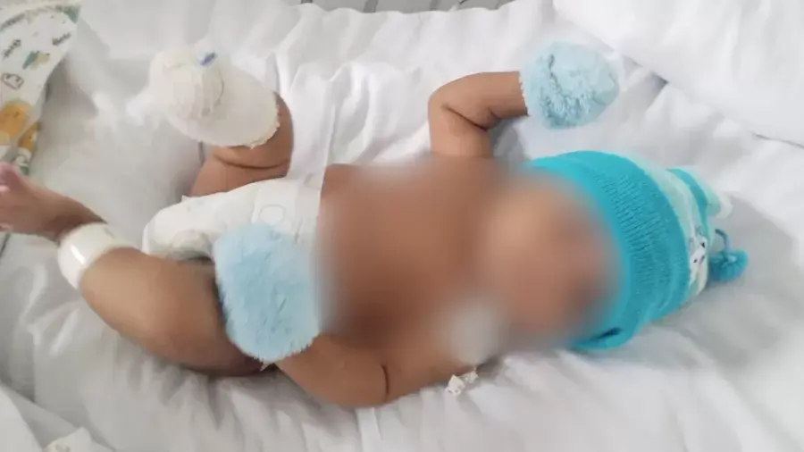 Bebê tem pé amputado na Bahia e família denuncia negligência médica