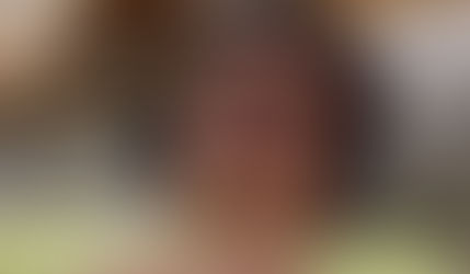 Bolsonaro apresenta melhora na função renal, mas segue internado na UTI