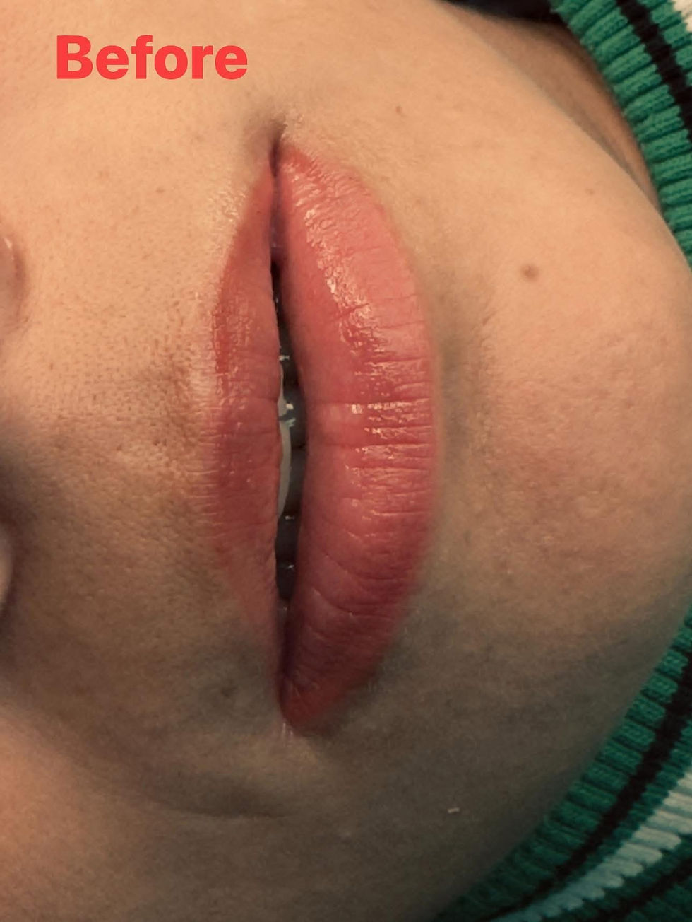 Soft Lip Blush Transformation – Before & After with Premium Pigments