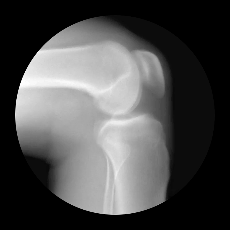 knee xray gif