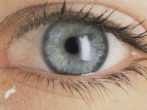 Close-up of a healthy, well-lubricated eye representing how acupuncture may support tear production and relieve dry eye syndrome naturally.