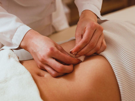 Woman receiving acupuncture for IBS and digestive health in a calming wellness clinic.