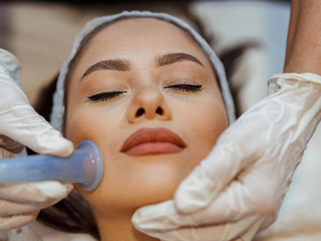 Woman receiving facial cupping treatment to promote healthy circulation, reduce puffiness, and support naturally glowing skin.