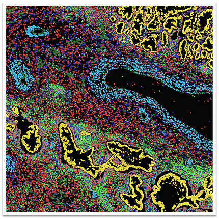 Project 5 omics Xenium.png