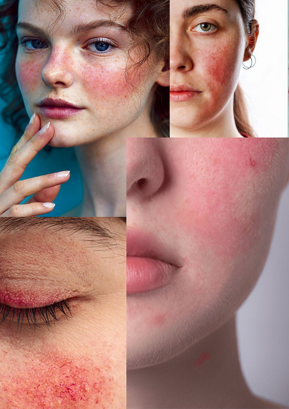Danger of wrong skincare
