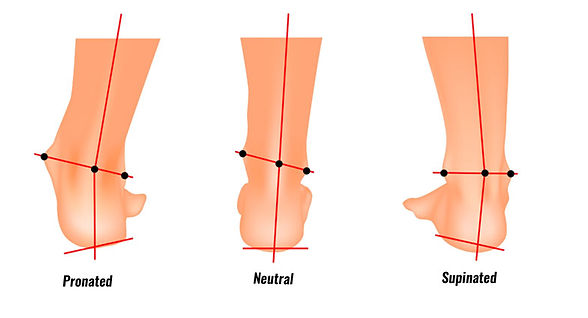 Over Pronation & Over Supination
