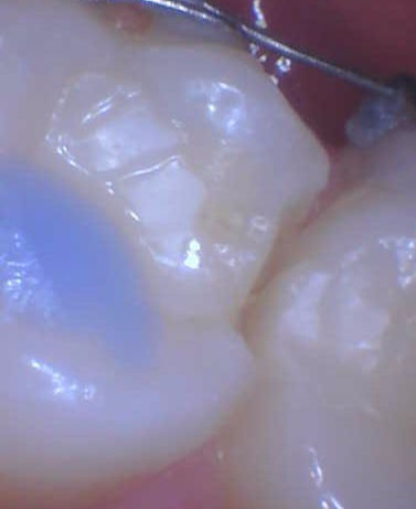 Case of the day 5/11/2020