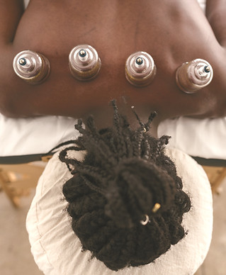 Cupping Therapy_edited.jpg