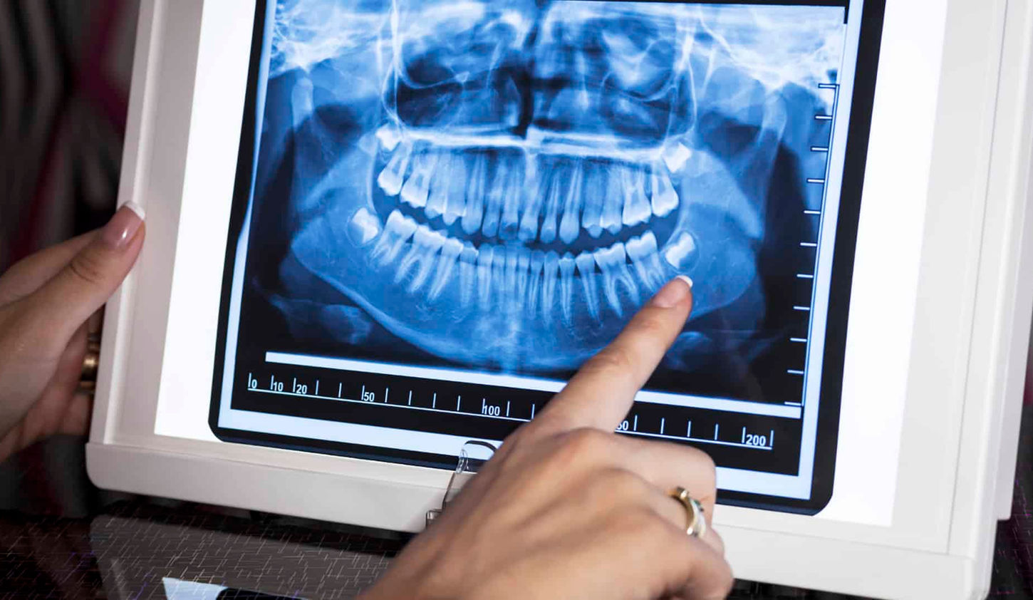 are-dental-xrays-safe.jpg