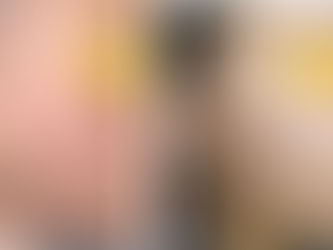 איך נפטרים מאקנה?