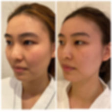 i-firm 線體霜 效果2.jpeg