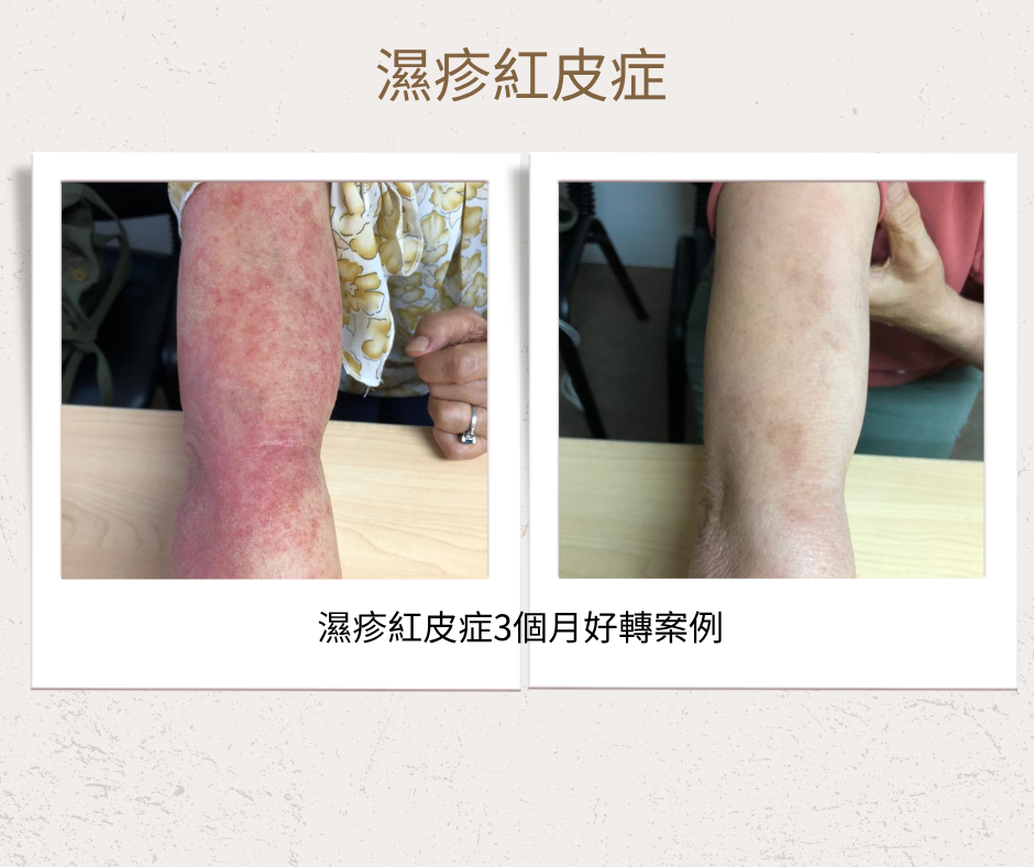 濕皮2.1.png