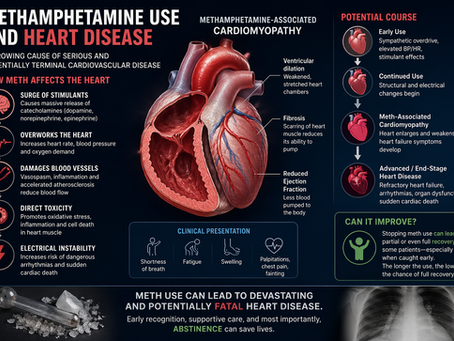 Methamphetamine-Associated Cardiomyopathy