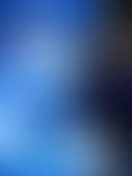 Microneedling mit Exososmen in Bonn