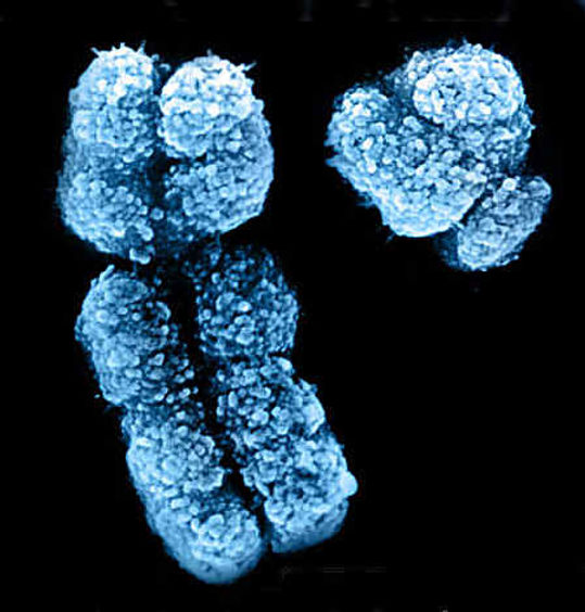 X chromosome on the left, Y chromosome on the right