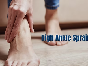High Ankle Sprain: What is it?