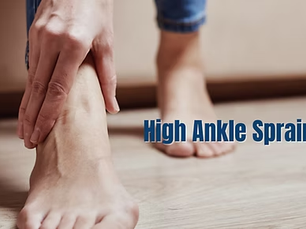 High Ankle Sprain: What is it?