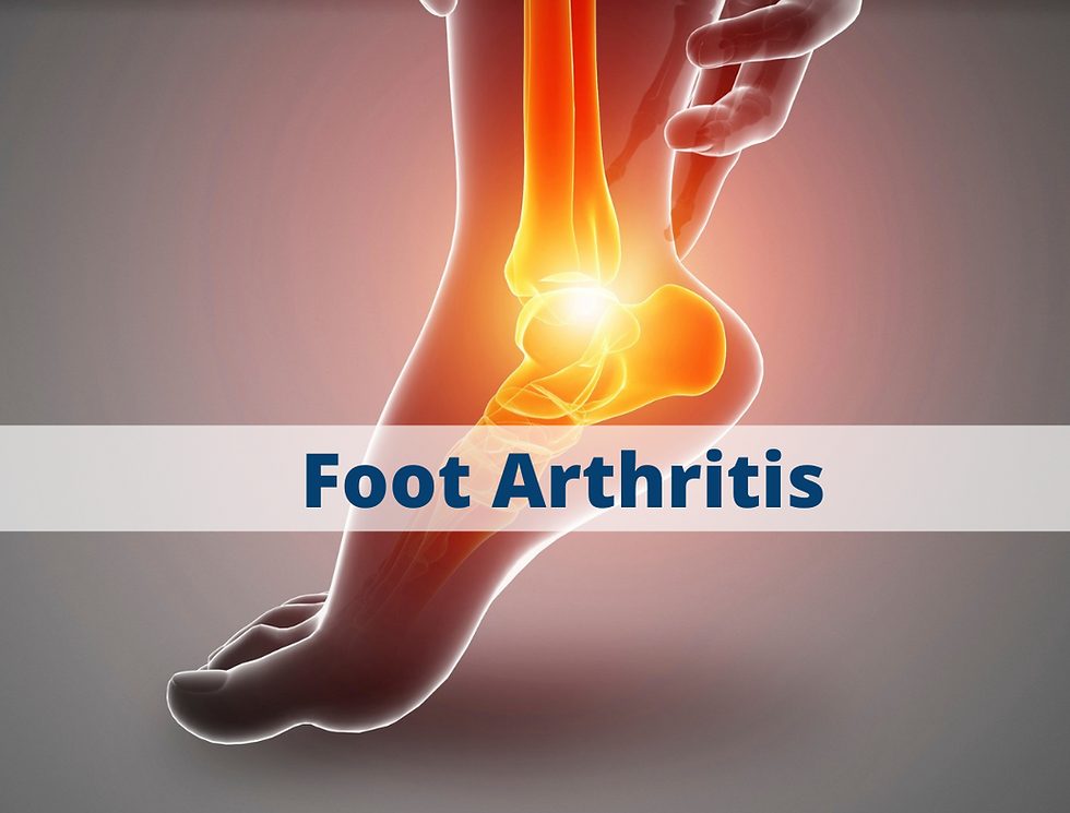 Foot Arthritis.png