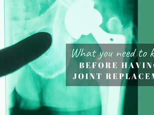 BEFORE HAVING A JOINT REPLACEMENT... What you need to know