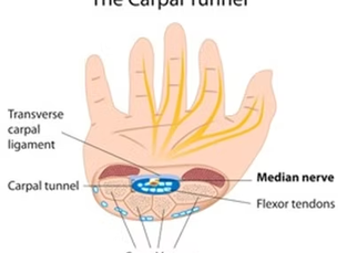 Carpal Tunnel: A Look Inside