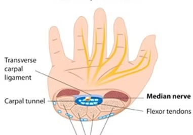 Carpal Tunnel: A Look Inside