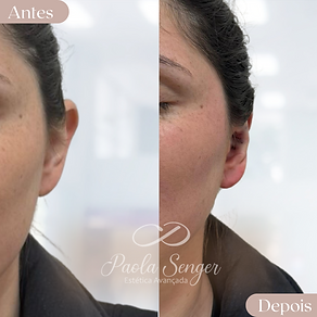 Otomodelção curitiba 