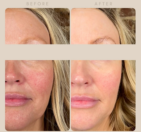 before-after medium.png