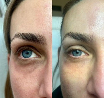 before-after thin.jpg