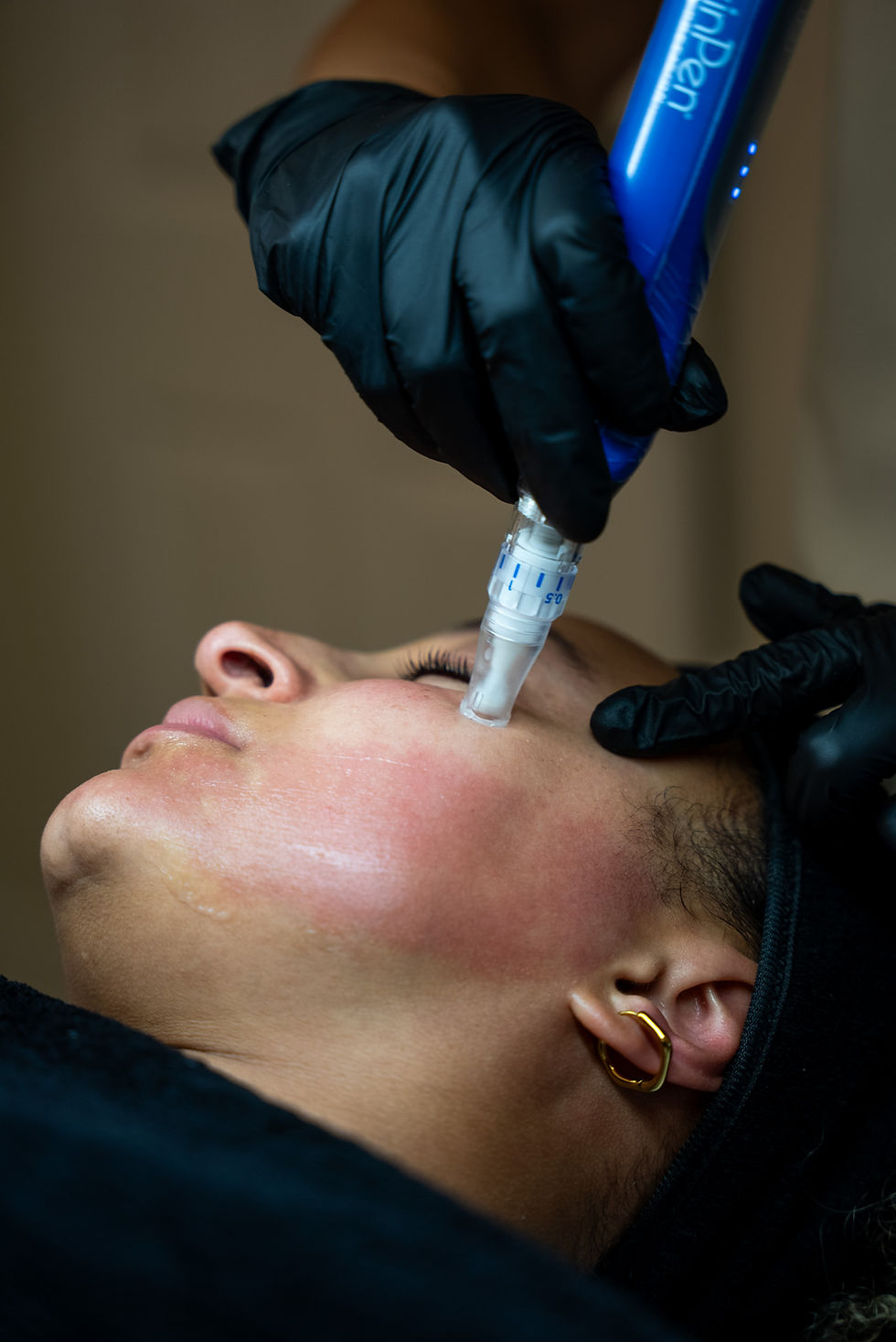 Female client having the HydraFacial treatment delivered at Empress Skin.