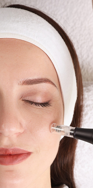 microneedling 1_edited.jpg