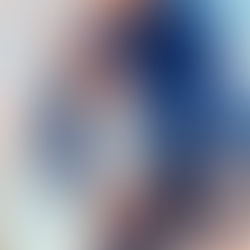 Shin Splints: What Causes Them and Why Do They Happen?