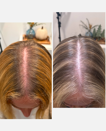 Before and after