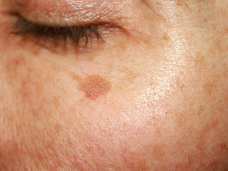 Sun-Damaged Skin? Here are 8 products you can use to Brighten and Regenerate Naturally with Natural Territory.