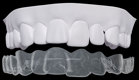 Confortabile si nedureroase (SPARK Aligners) - DCOrto #DCOrto #Spark #Orthodont #teeth #al