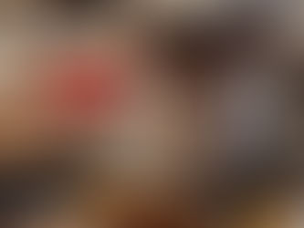 Sugar Intake Weakening Immune System